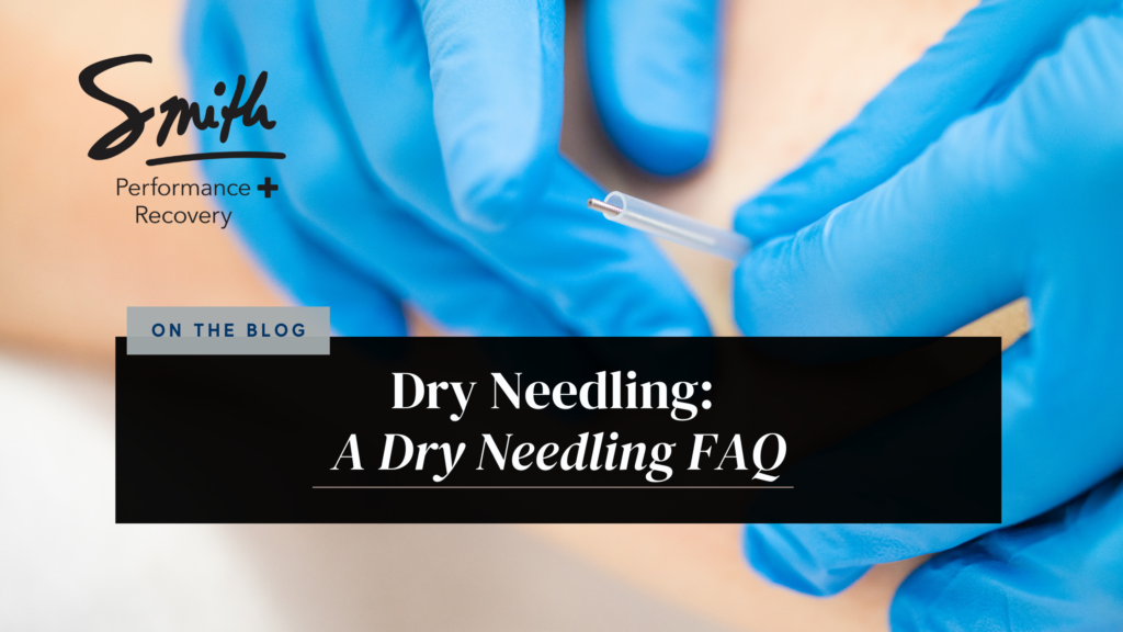 Dry Needling FAQ